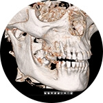 badanie CBCT